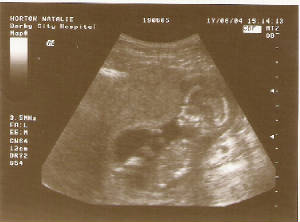 baby1.jpg