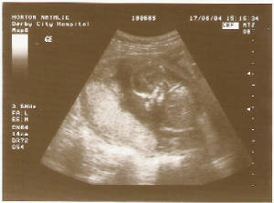 baby2.jpg